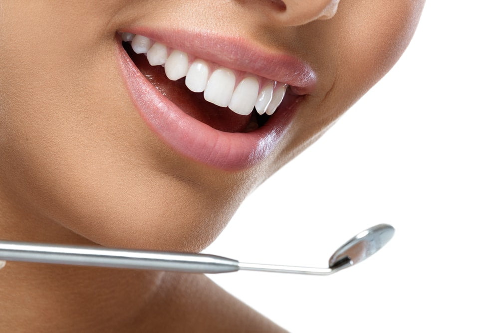 10 Things You Should Know About Teeth Whitening